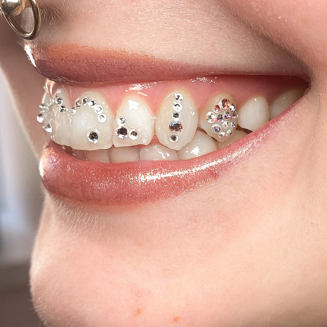 Safe Tooth Gems: Enhancing Your Smile without Compromising Your Oral Health